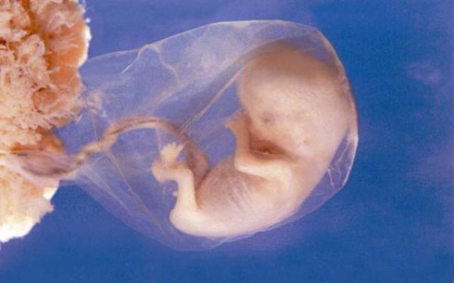 11 Week Baby Development In Womb